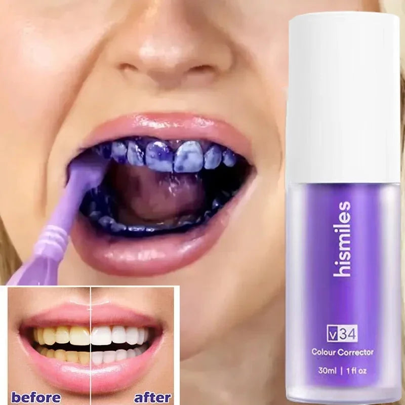 🦷 SmileKit Whitening Purple Toothpaste