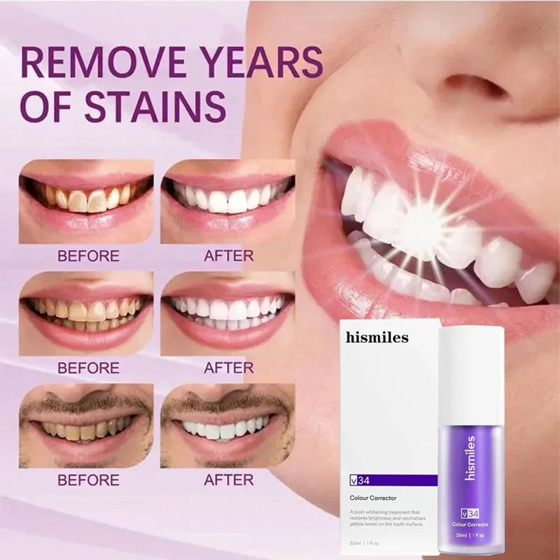 🦷 SmileKit Whitening Purple Toothpaste