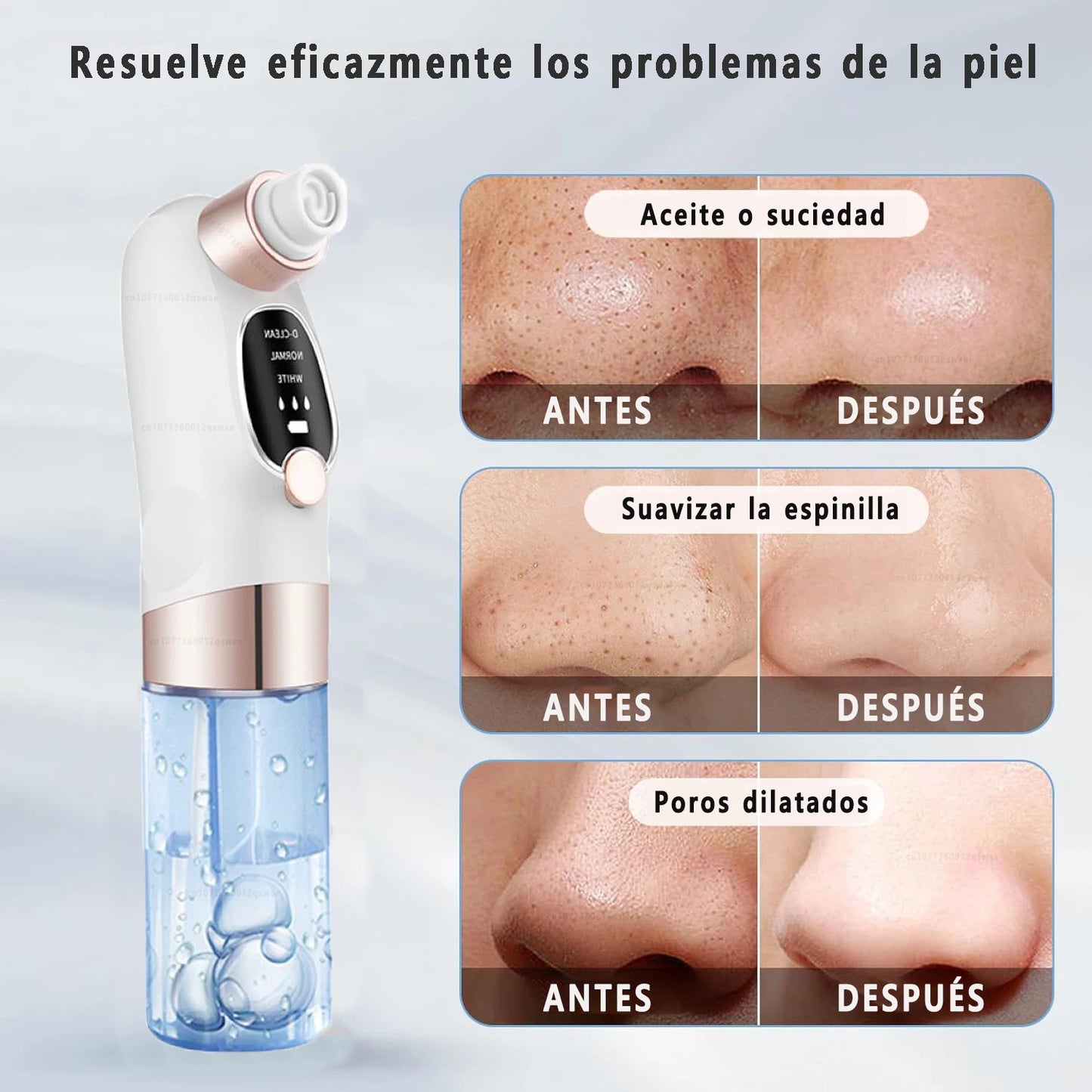Vacuum – Deep Pore Cleansing Device