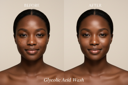 Glycolic wash for dark spots